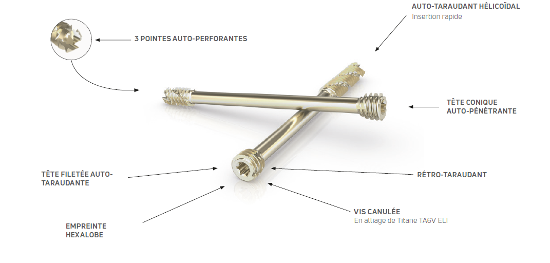 Nexis rear caractéristiques