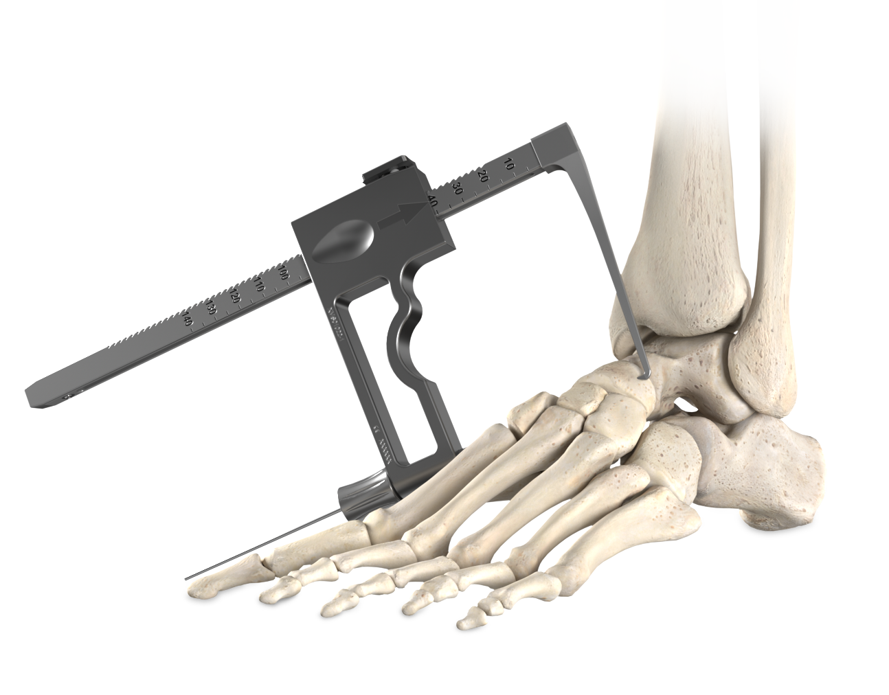 Hindfoot Targeter Image