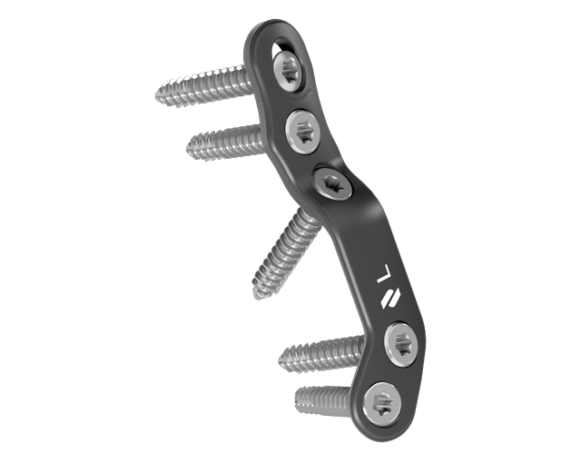 lapidus-plates-plantar